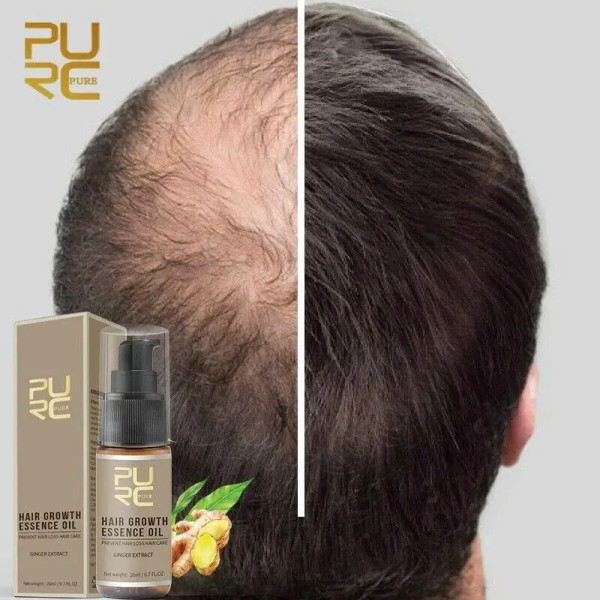Спрей для роста волос Pure