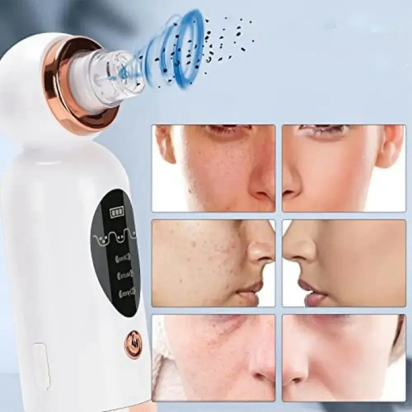 Вакуумный очиститель Face Slimmer для ухода за кожей лица и пор