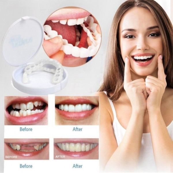 Съемные виниры для зубов Smile Veneers White, накладные зубы, накладки для зубов