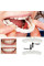Съемные виниры для зубов Smile Veneers White, накладные зубы, накладки для зубов