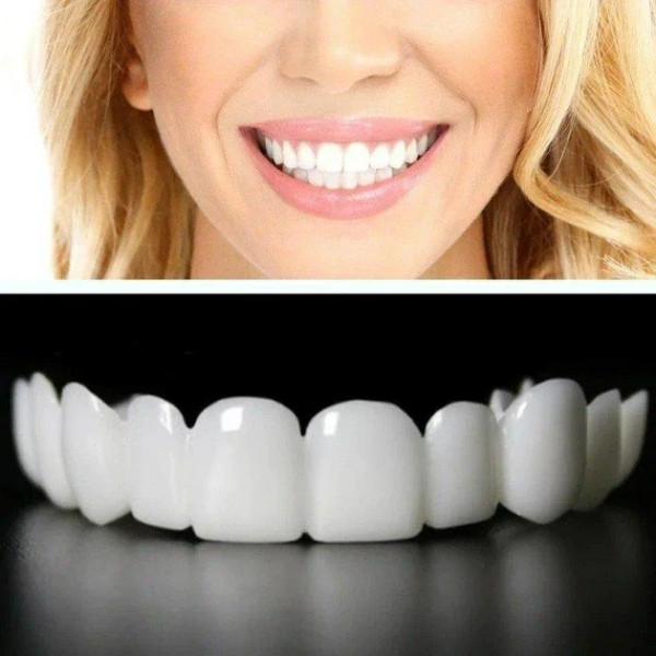 Съемные виниры для зубов Smile Veneers White, накладные зубы, накладки для зубов