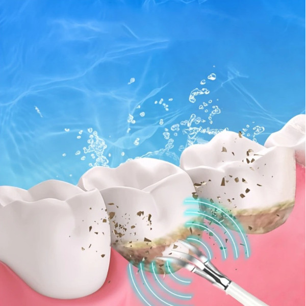 Ультразвуковая зубная щётка-скалер 2в1 Electric Sonic Dental Scaler с насадками и зеркалом,для удаления налета
